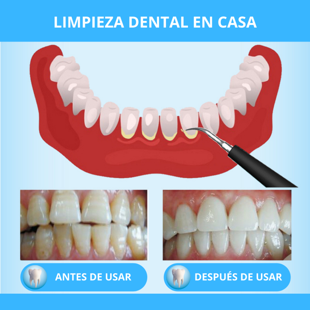 Removedor con Ultrasonido de Manchas y Sarro Dental + Cepillo Eléctrico